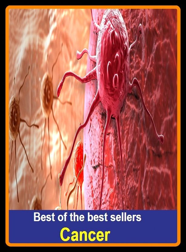 Best of the best sellers Cancer ( malignant neoplastic disease, cancer, genus Cancer, crab louse, malignant neoplastic disease, crabby person, crab meat, genus Cancer, pubic louse)
