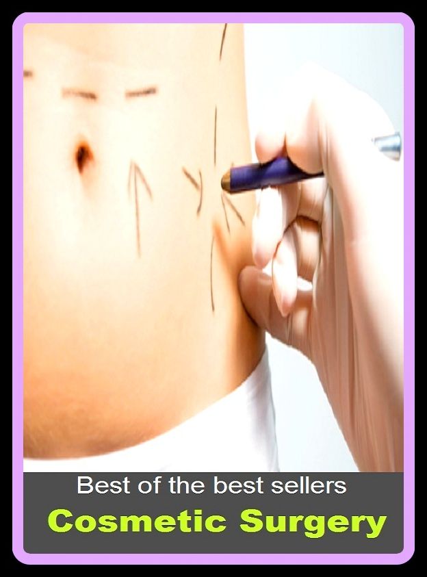 Best of the Best Sellers Cosmetic Surgery (rise, cosmetic surgery, nip and tuck, heave, face lifting, lift, ski lift, airlift, facelift, elevation, hysterectomy, ski tow, raising, face lift, elevator, angioplasty, aerodynamic lift, raise)