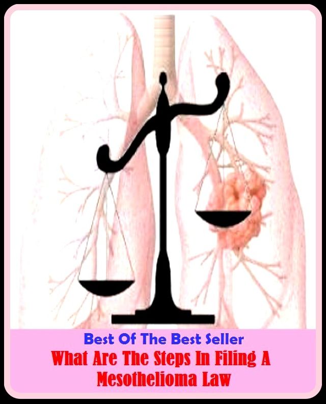 Best of the Best Sellers What Are The Steps In Filing A Mesothelioma Law ( Steps , back stairs, treads and risers, companionway, steps and measures, fire escape, stairway, forearming, staircase, foresight)