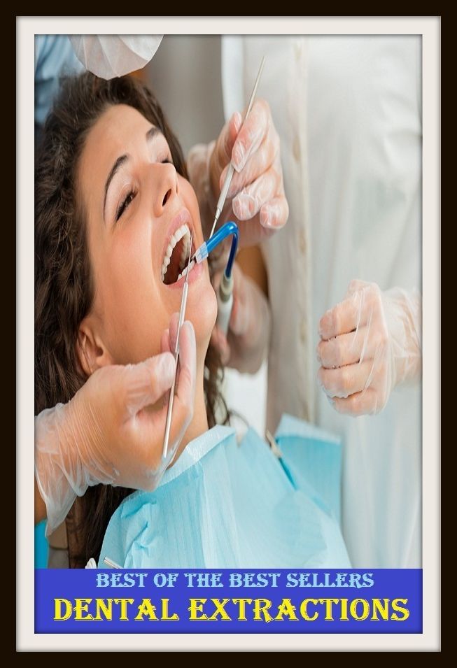Best of the Best Sellers Dental Extractions ( dental, odontic, controlled, restrained, dental, made of tooth, cuspidal, dental, odontic )