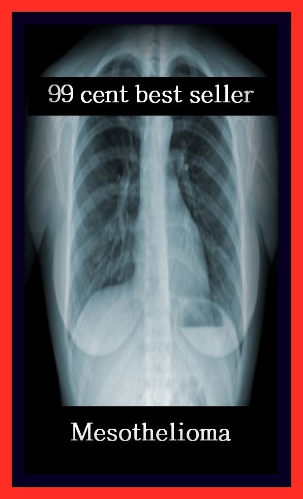 99 Cent Best Seller Mesothelioma ( exercise, meditation, acupuncture, disease, digestive system, formula, medicine, remedy, fix, treatment, action, conduct, behavior, handling, gastrin, fitness, vitamins, healing, diet, cut down, starve yourself, fast )