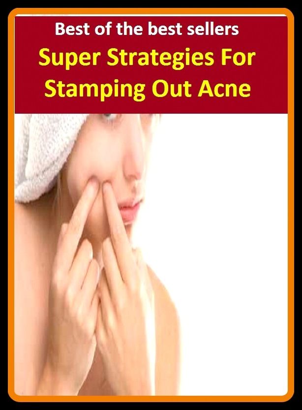 Best of the best sellers Super Strategies For Stamping Out Acne ( stamper, stamping, stamping ground, stamping machine, stamping mill, stamp less, stamp pot, stamps, stablemate, stein)