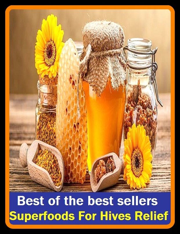 Best of the best sellers Super foods For Hives Relief ( lively, hive mind, giver, hibernate, hives, hive technologies, hiving, kiwi, hi wired, Hinayana)