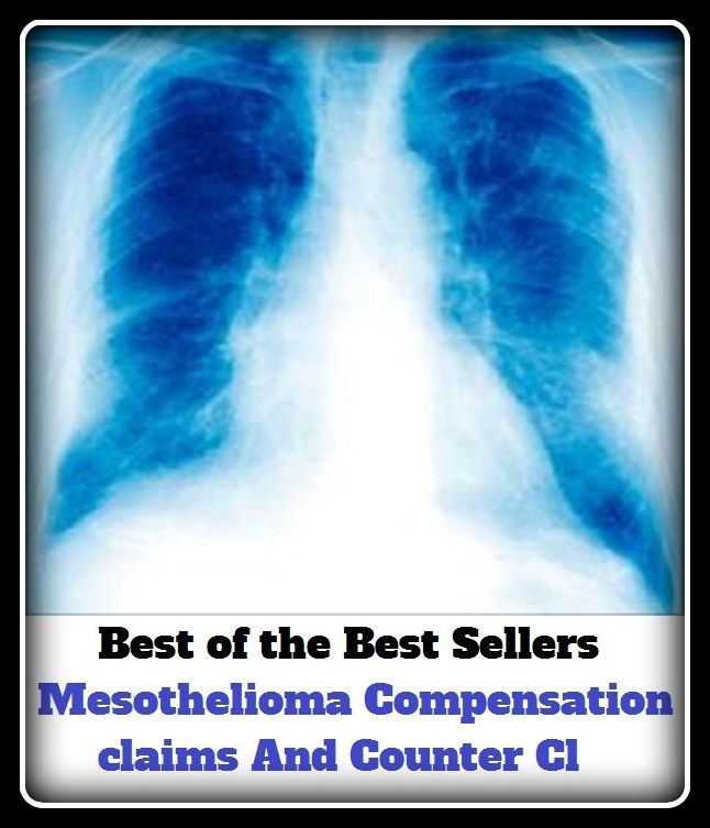 Best of the Best Sellers Mesothelioma Compensation claims And Counter Cl ( compensation, indemnification, amends, reparation, indemnity, recompense, claim, demand, right, call, assertion, pretension )