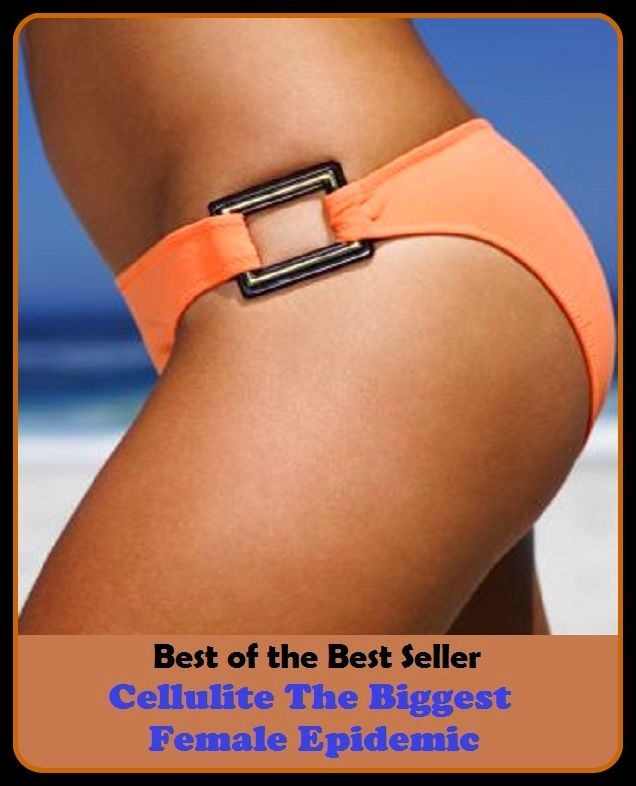 Best of the Best Sellers Cellulite The Biggest Female Epidemic (contagious, catching, sweeping, prevalent, endemic, general, communicable, rampant, infectious, pandemic, prevailing, rife)