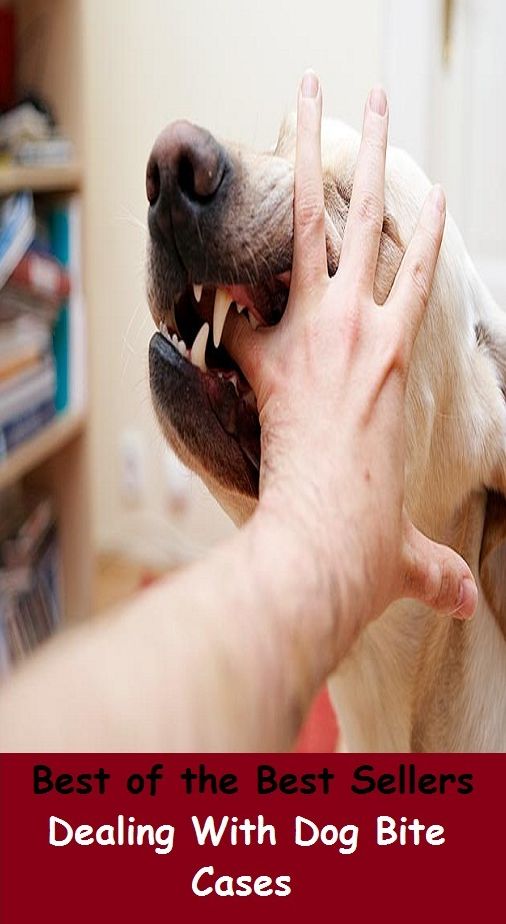 Best of the Best Sellers Dealing With Dog Bite Cases (doggie, pooch, sheepdog, house dog, barker, pup, puppy, bitch, cur, hound, mongrel)