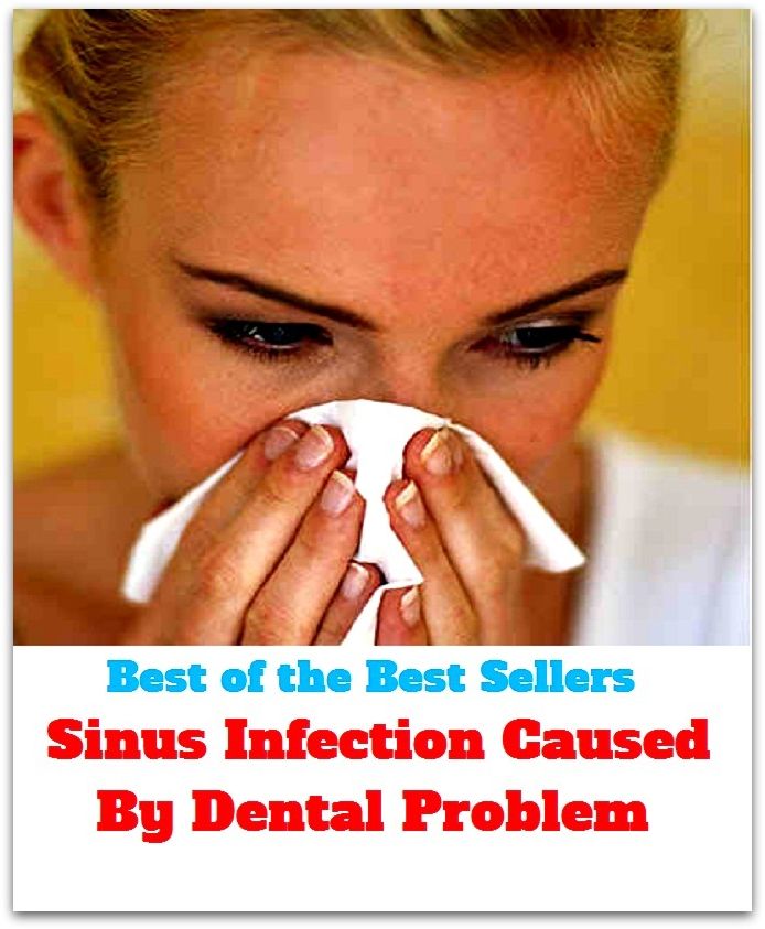 Best of the best sellers Sinus Infection Caused By Dental Problem ( exercise, meditation, acupuncture, disease, digestive system, formula, medicine, remedy, fix, treatment, action, conduct, behavior, handling, gastrin, fitness, vitamins, healing, diet )