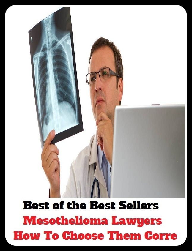 Best of the Best Sellers Mesothelioma Lawyers How To Choose Them Corre ( advocate, counselor, attorney, barrister, counsel, counsellor, defender, jurist, mouthpiece, pleader )