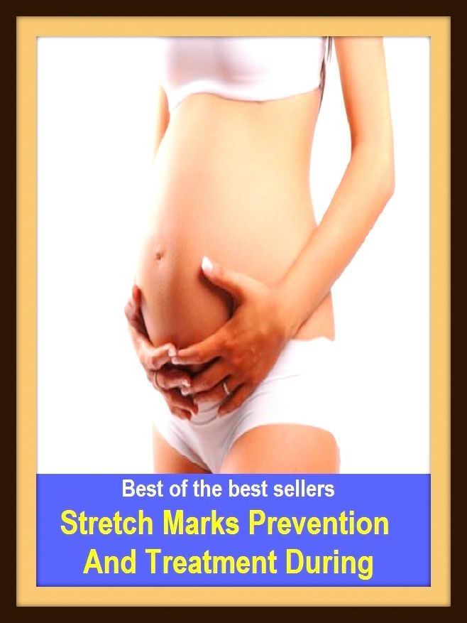 Best of the Best Sellers Stretch Marks Prevention And Treatment During (behavior, conduct, dealing, act, attitude, dealing, arrangement, provision, disposition, preparation)
