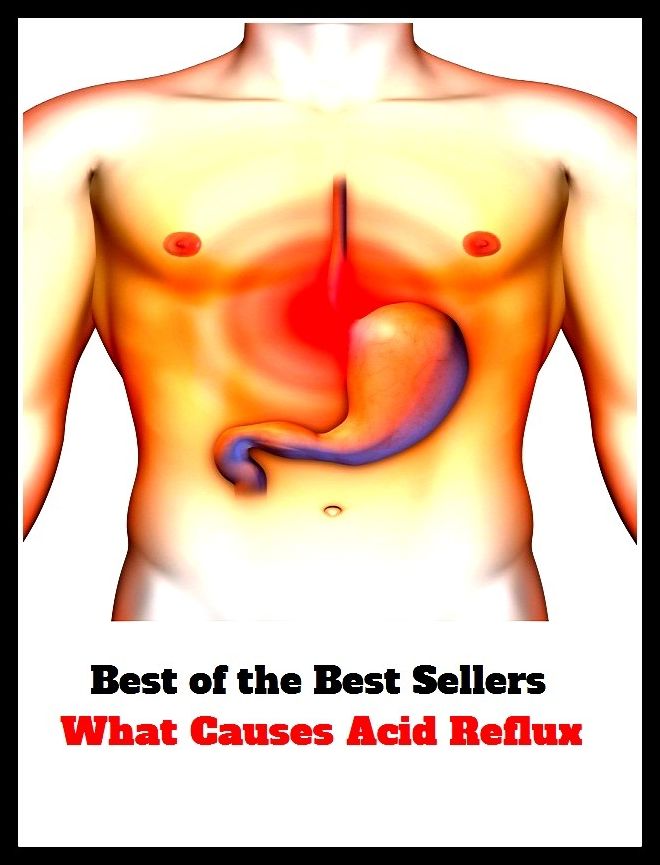 Best of the best sellers What Causes Acid Reflux ( exercise, meditation, acupuncture, disease, digestive system, formula, medicine, remedy, fix, treatment, action, conduct, behavior, handling, gastrin, fitness, vitamins, healing, diet, cut down )