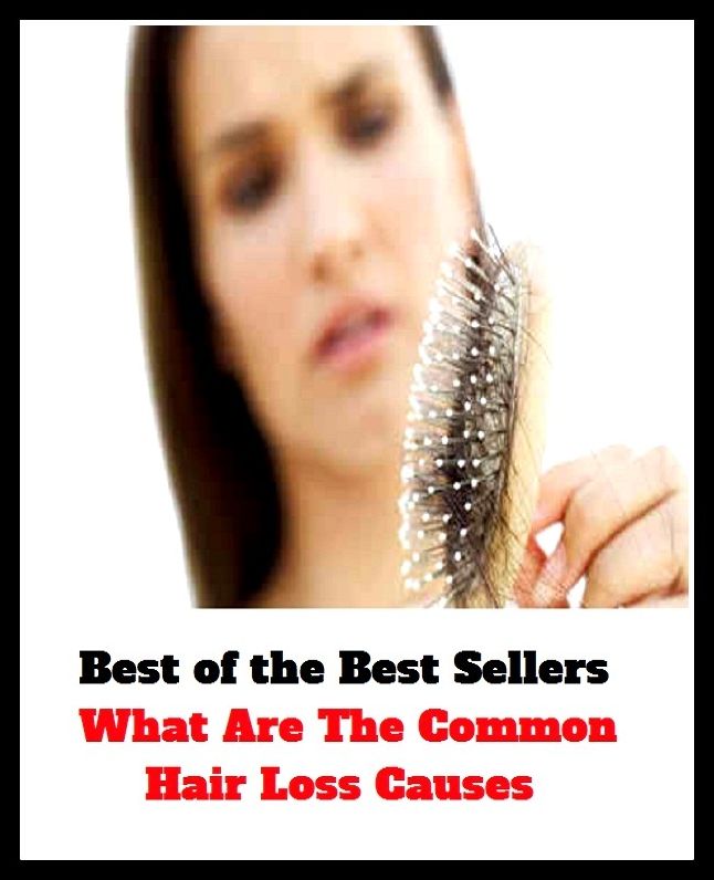 Best of the best sellers What Are The Common Hair Loss Causes ( exercise, meditation, acupuncture, disease, digestive system, formula, medicine, remedy, fix, treatment, action, conduct, behavior, handling, gastrin, fitness, vitamins, healing, diet )