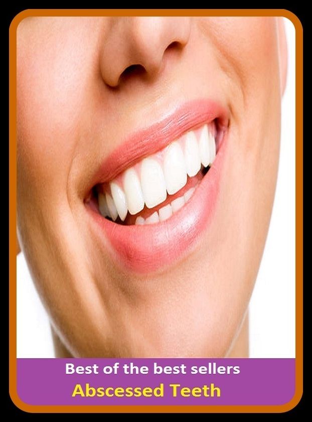 Best of the Best Sellers Abscessed Teeth ( notch, teeth, groove, indentation, nick, notching, tooth, pricker, needle, pin, bradawl )