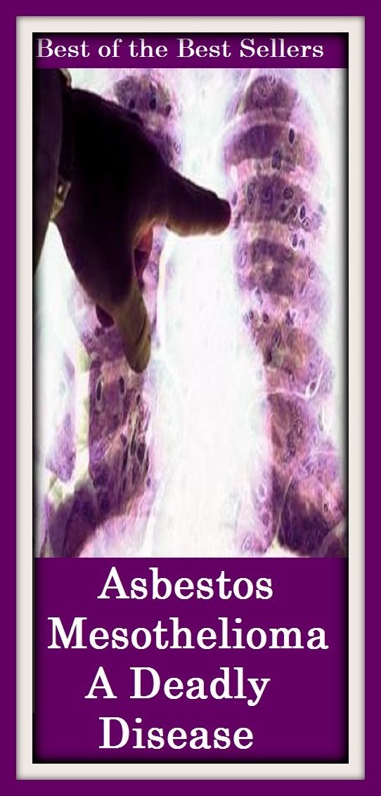 Best of the best sellers Asbestos Mesothelioma A Deadly Disease ( exercise, meditation, acupuncture, disease, digestive system, formula, medicine, remedy, fix, treatment, action, conduct, behavior, handling, gastrin, fitness, vitamins, healing, diet )