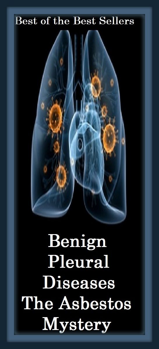 Best of the best sellers Benign Pleural Diseases The Asbestos Mystery ( exercise, meditation, acupuncture, disease, digestive system, formula, medicine, remedy, fix, treatment, action, conduct, behavior, handling, gastrin, fitness, vitamins, healing )