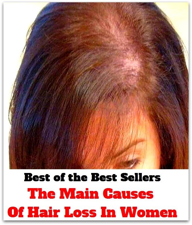 Best of the best sellers The Main Causes Of Hair Loss In Women ( exercise, meditation, acupuncture, disease, digestive system, formula, medicine, remedy, fix, treatment, action, conduct, behavior, handling, gastrin, fitness, vitamins, healing, diet )