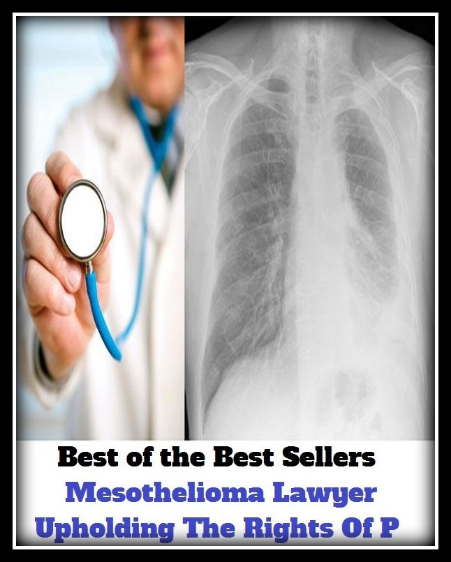 Best of the Best Sellers Mesothelioma Lawyer Upholding The Rights Of P ( advocate, counselor, attorney, barrister, counsel, counsellor, defender, jurist, mouthpiece, pleader )