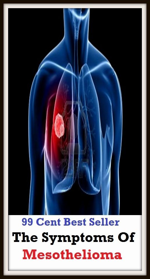 99 Cent Best Seller The Symptoms Of Mesothelioma ( Mystery, romance, action, adventure, sci fi, science fiction, drama horror thriller, classic, novel, literature, suspense)