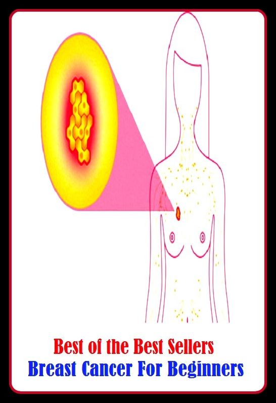 99 Cent Best Seller Breast Cancer For Beginners ( exercise, meditation, acupuncture, disease, digestive system, formula, medicine, remedy, fix, treatment, action, conduct, behavior, handling, gastrin, fitness, vitamins, healing, diet, cut down )