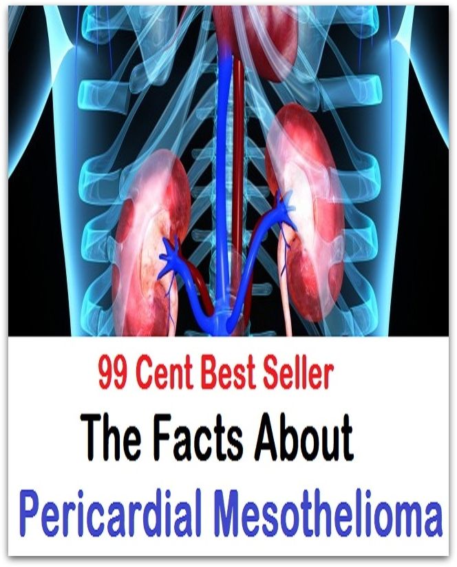 99 Cent Best Seller The Facts About Pericardial Mesothelioma (Ethics, Chicken Soup, Thought, Theory, Self Help, Mystery, romance, action, adventure, sci fi, science fiction, drama, horror, thriller, classic, novel, literature, suspense)