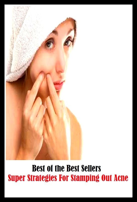 99 Cent Best Seller Super Strategies For Stamping Out Acne ( exercise, meditation, acupuncture, stylostixis, drug, formula, medicine, remedy, fix, treatment, action, conduct, behavior, handling, dealing, fitness, vitamins, healing )