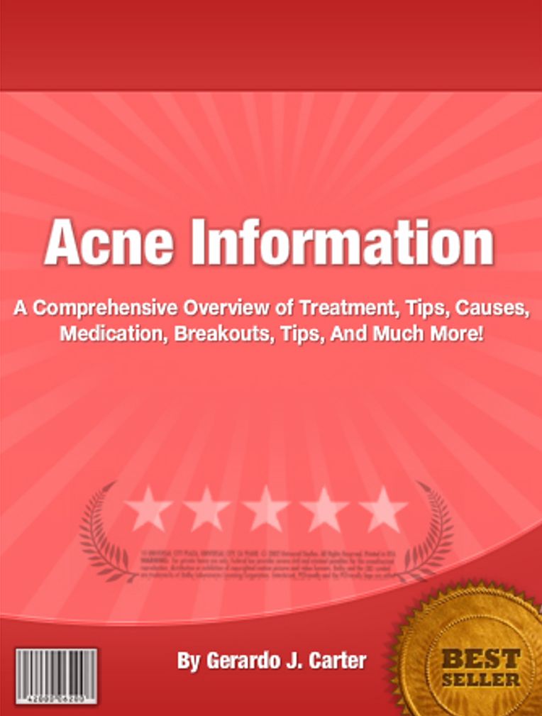 Acne Information: A Comprehensive Overview of Treatment, Tips, Causes, Medication, Breakouts, Tips, And Much More!
