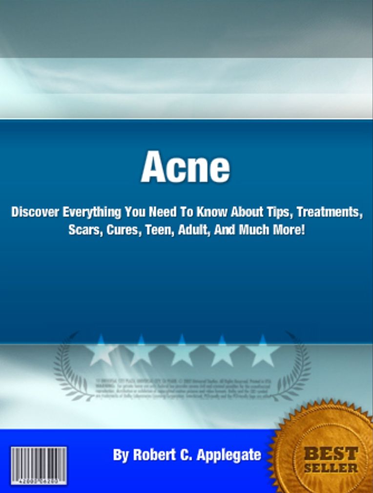 Acne: Discover Everything You Need To Know About Tips, Treatments, Scars, Cures, Teen, Adult, And Much More!