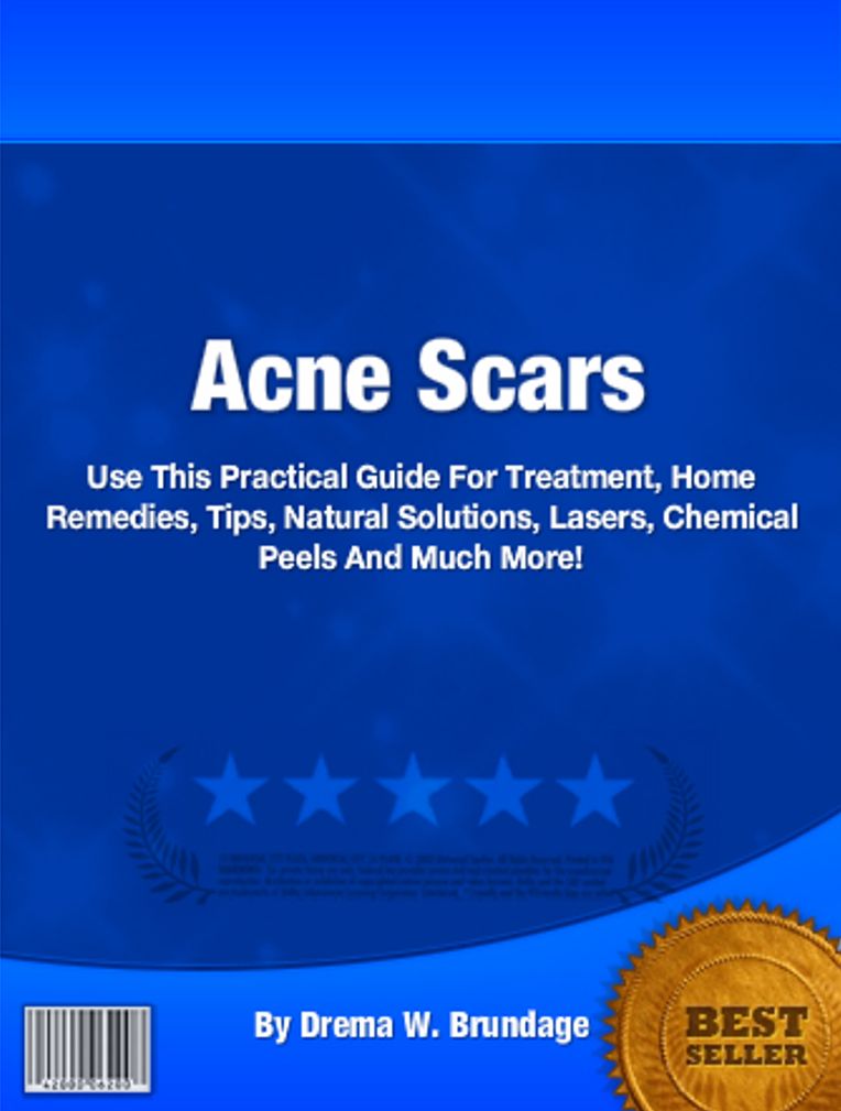 Acne Scars Use This Practical Guide For Treatment, Home Remedies, Tips, Natural Solutions, Lasers, Chemical Peels And Much More!