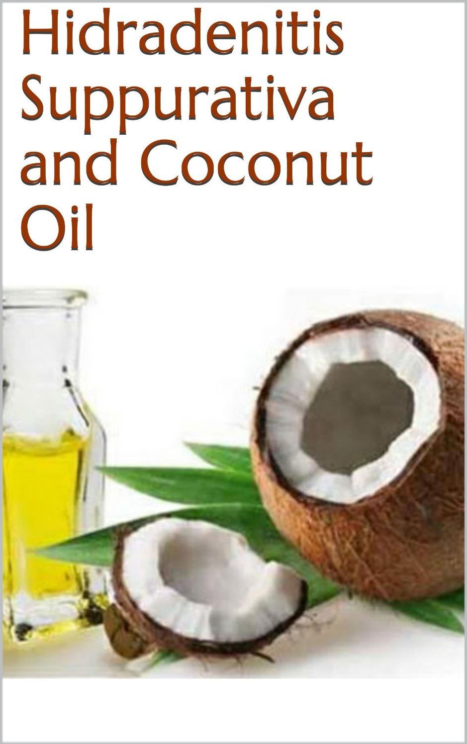 Hidradenitis Suppurativa and Coconut Oil