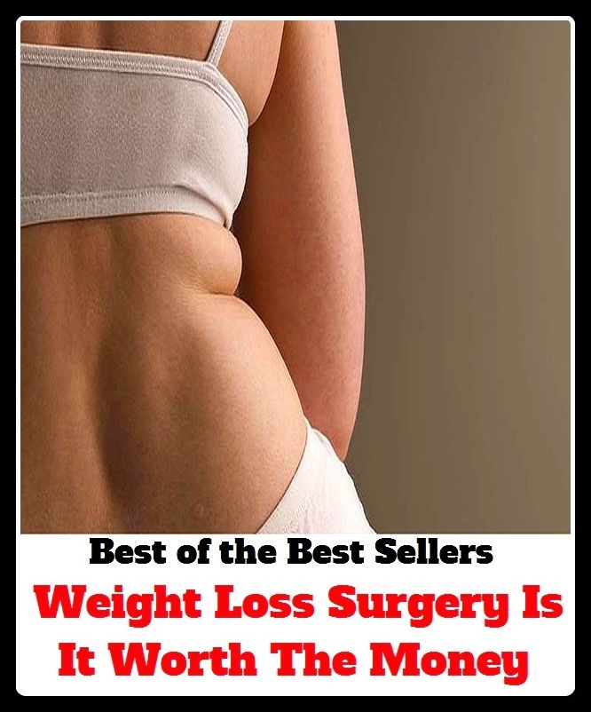Best of the Best Sellers Weight Loss Surgery Is It Worth The Money ( damage, loss, harm, hurt, deprivation, detriment, value, worth, price, cost, expense, charge )