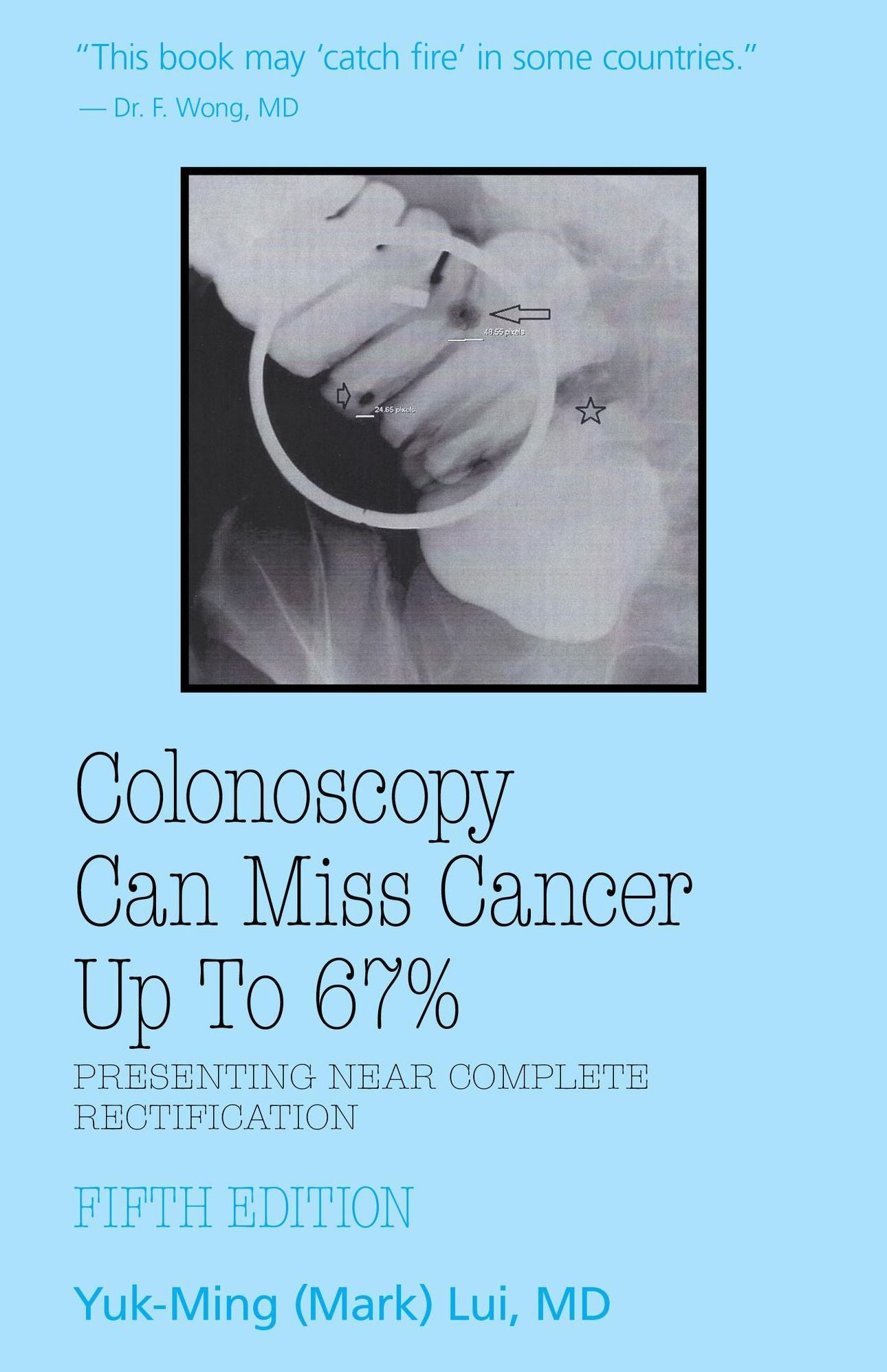 Colonoscopy