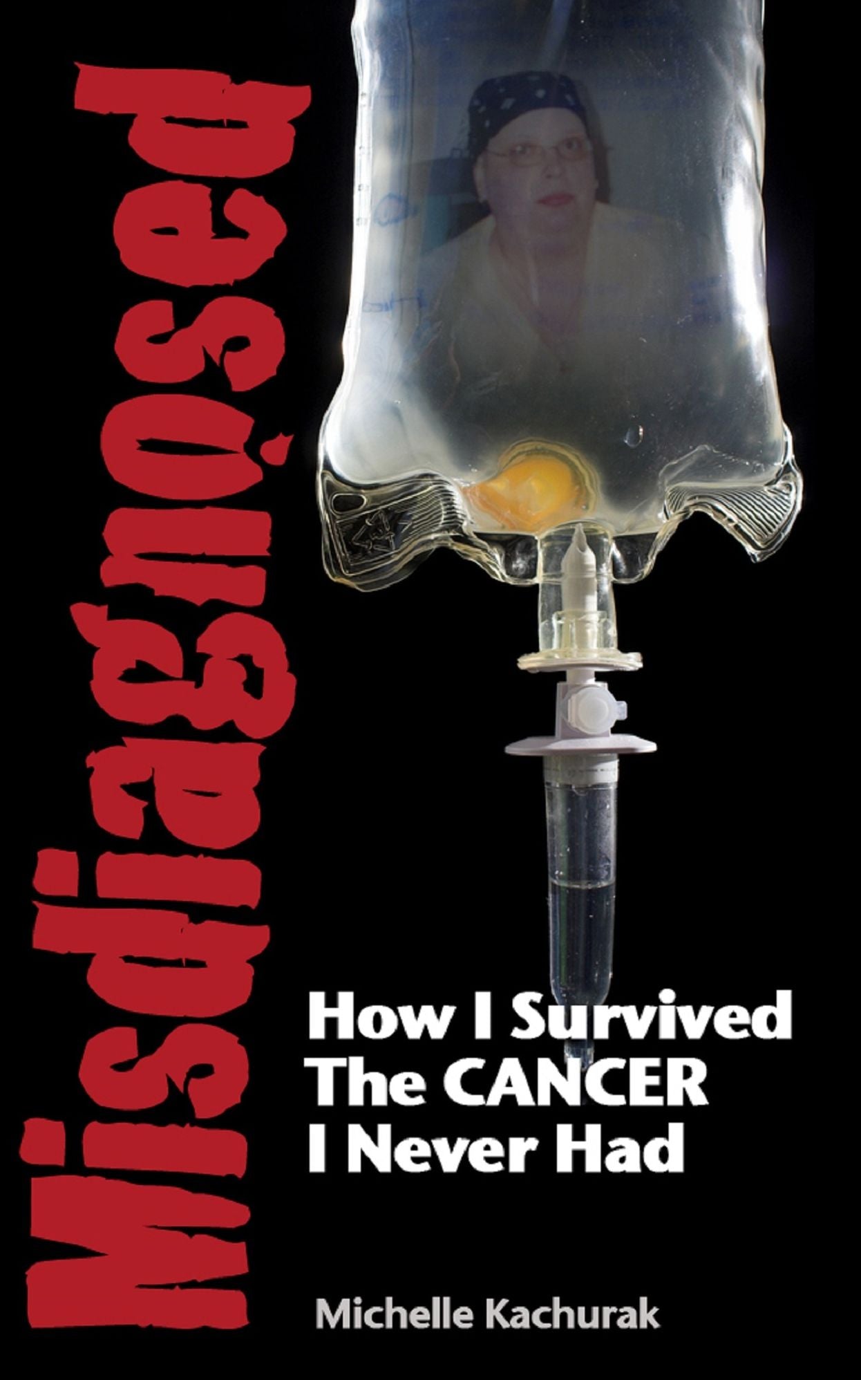 Misdiagnosed...How I Survived The CANCER I Never Had