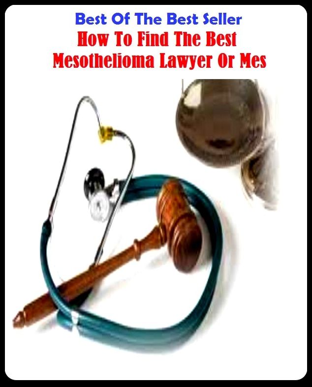 Best of the Best Sellers How To Find The Best Mesothelioma Lawyer Or Mes (a limb of law, counsellor, vakeel, jurist, legist, jurisconsult, barrister, advocate, diplomat, expert dice player, mouthpiece)