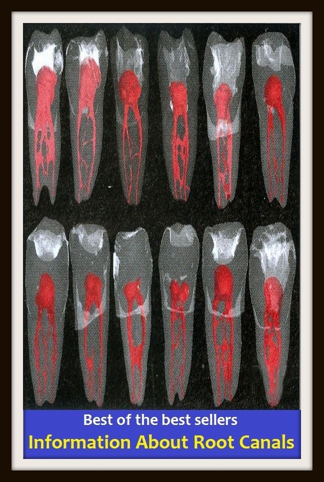 Best of the Best Sellers Information About Root Canals ( original, root, radix, bulb, beginning, embryo, reason, cause, motive, sake, base )