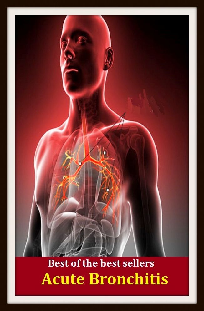 Best of the Best Sellers Acute Bronchitis (respiratory disease, adrenitis, torticollis, neuritis, laryngitisz, visceral rheumatism, arthritis deformans, irritable bowel,sore throat, osteomyelitis)