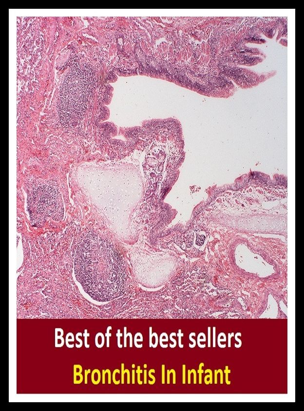 Best of the Best Sellers Bronchitis In Infant (respiratory disease, adrenitis, torticollis, neuritis, laryngitisz, visceral rheumatism, arthritis deformans, irritable bowel, sore throat, osteomyelitis)