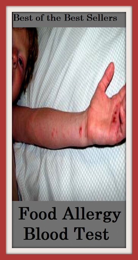Best of the Best Sellers Food Allergy Blood Test ( abhorrence, animosity, animus, antagonism, aversion, avoidance, bad blood, contrariety, distaste, ill will )