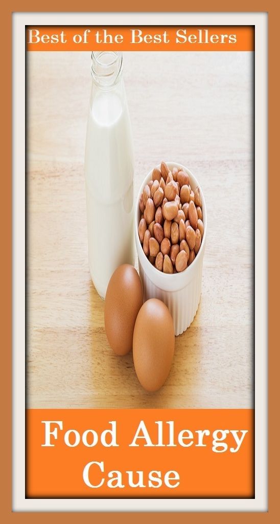 Best of the Best Sellers Food Allergy Cause ( abhorrence, animosity, animus, antagonism, aversion, avoidance, bad blood, contrariety, distaste, ill will )