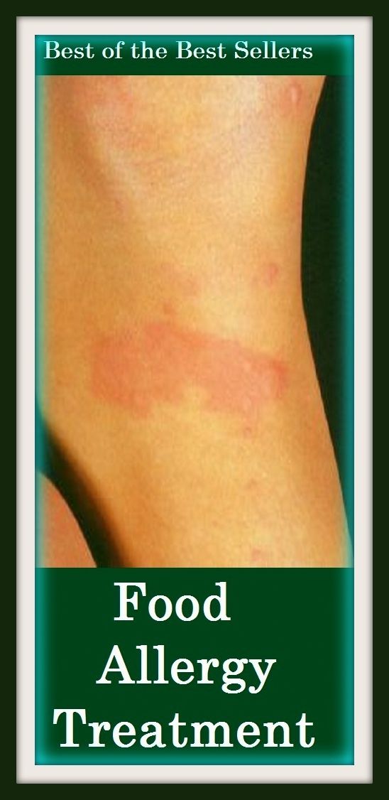 Best of the Best Sellers Food Allergy Treatment ( abhorrence, animosity, animus, antagonism, aversion, avoidance, bad blood, contrariety, distaste, ill will )