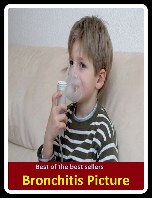 Best of the Best Sellers Bronchitis Picture (respiratory disease, adrenitis, torticollis, neuritis, laryngitisz, visceral rheumatism, arthritis deformans, irritable bowel, sore throat, osteomyelitis)