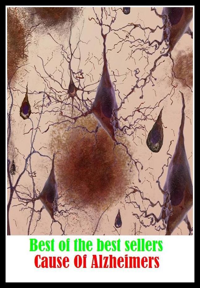 Best of the Best Sellers Cause Of Alzheimers (exhume, ill humor, ex hume, elsewhere, all same, ill-humor, ex-hume, unearth, reveal, disclose)