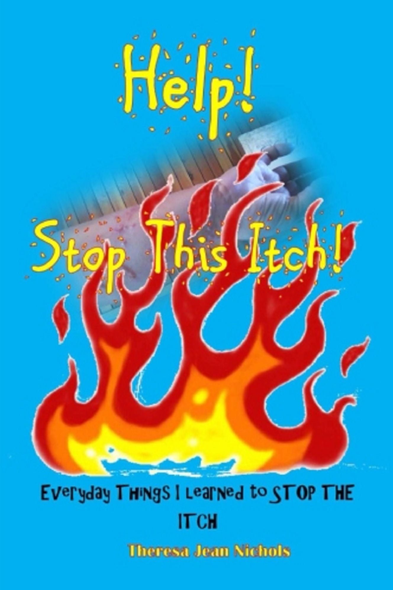 Help! Stop This Itch!