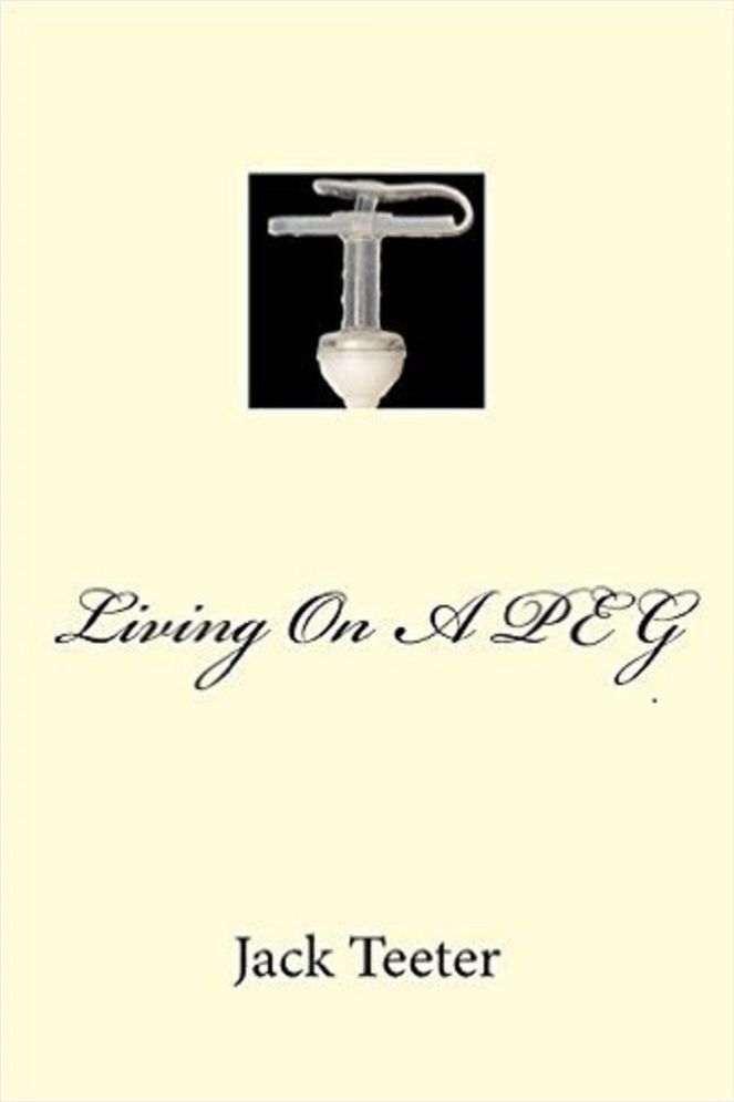 Living On A PEG