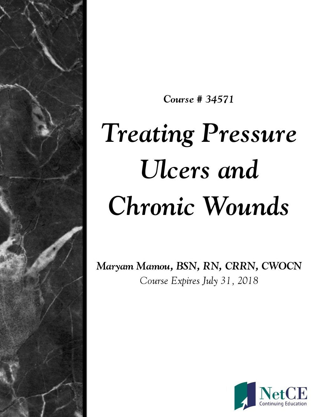 Treating Pressure Ulcers and Chronic Wounds