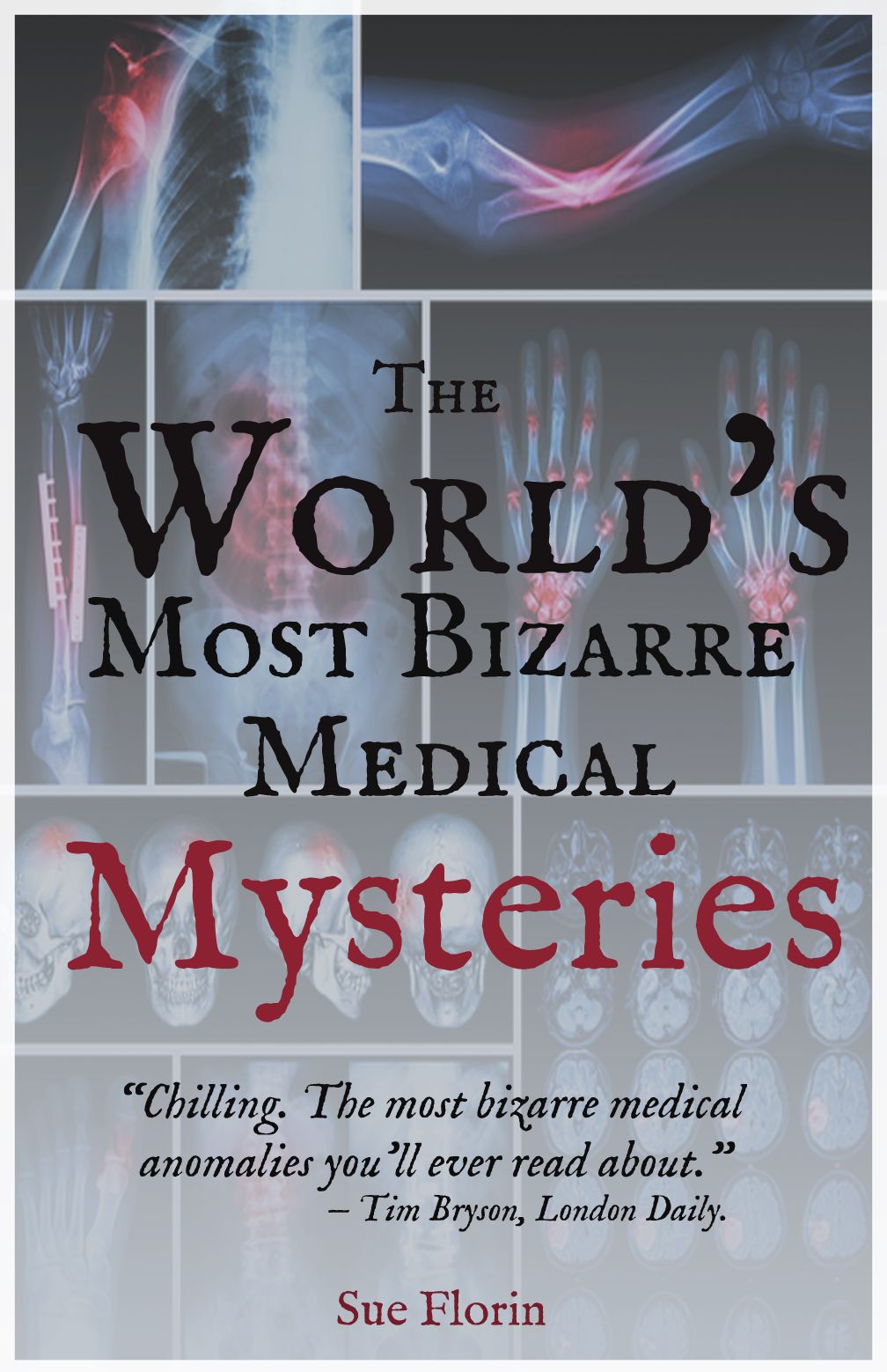 The World's Most Bizarre Medical Mysteries