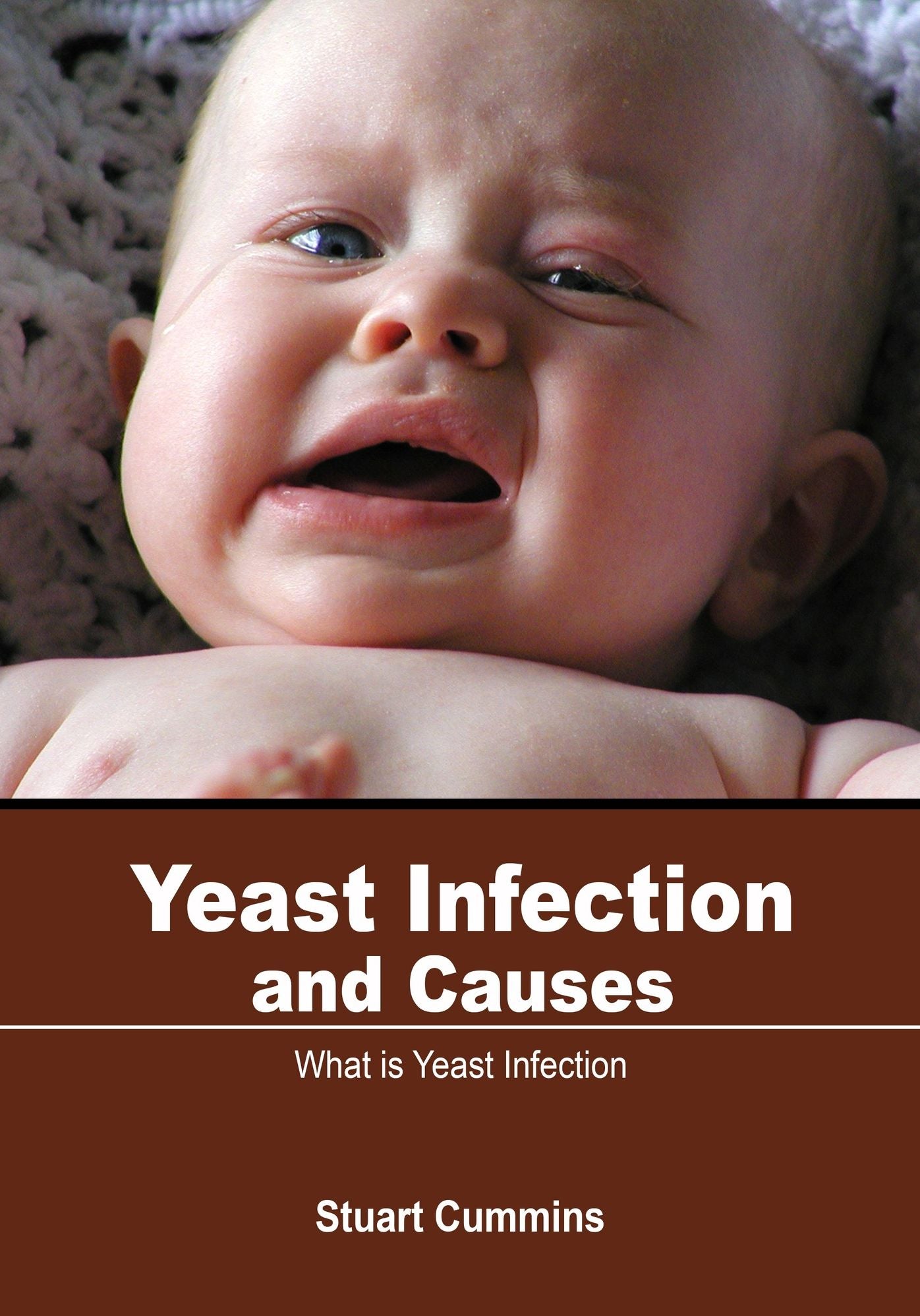Yeast Infection And Causes