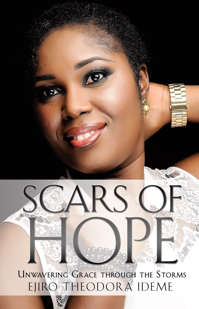 Scars of Hope