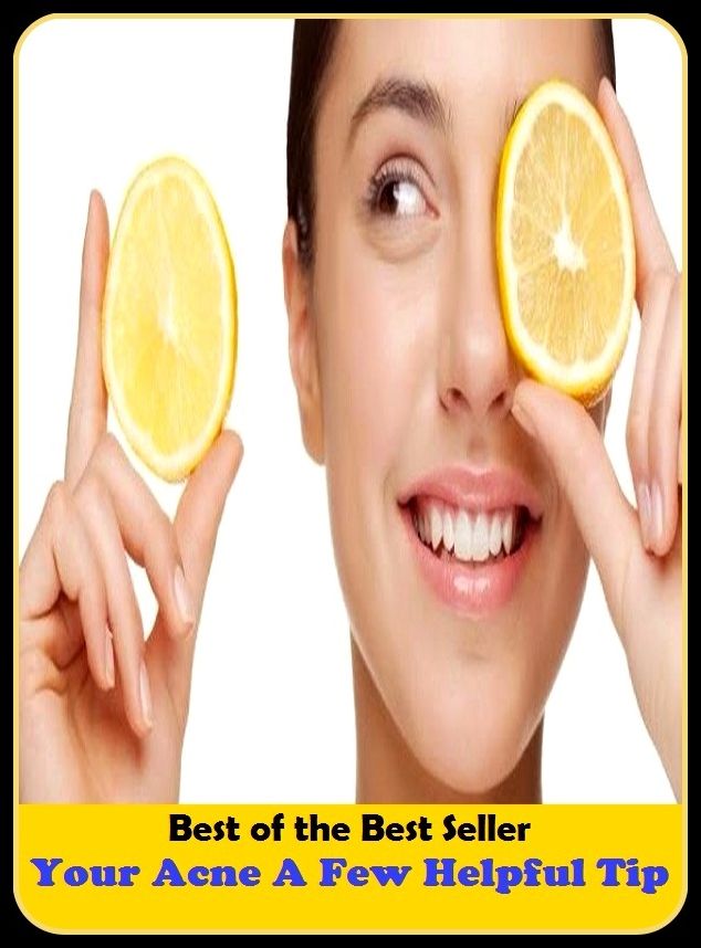 Best of the Best Sellers Your Acne A Few Helpful Tip(blackheads,pimples,pustules,rosacea,zits, whiteheads, skin inflammation, pizza face, tumor, eruption)