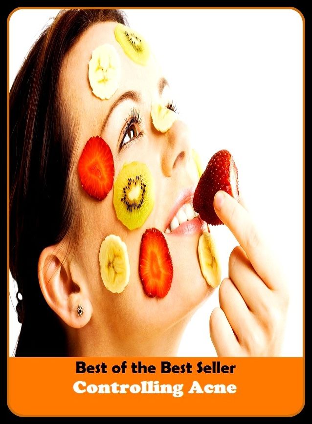Best of the Best Sellers Controlling Acne (blackheads,pimples,pustules,rosacea,zits, whiteheads, skin inflammation, pizza face, tumor, eruption)