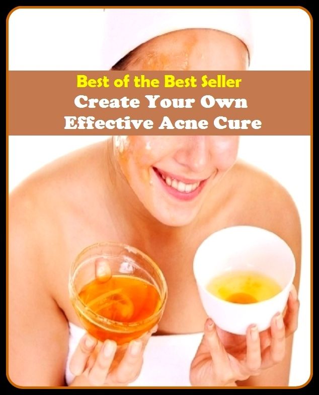 Best of the Best Sellers Create Your Own Effective Acne Cure (blackheads,pimples,pustules,rosacea,zits, whiteheads, skin inflammation, pizza face, tumor, eruption)