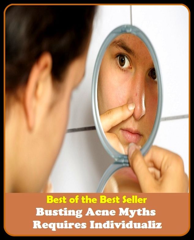 Best of the Best Sellers Busting Acne Myths Requires Individualiz(blackheads,pimples,pustules,rosacea,zits, whiteheads, skin inflammation, pizza face, tumor, eruption)